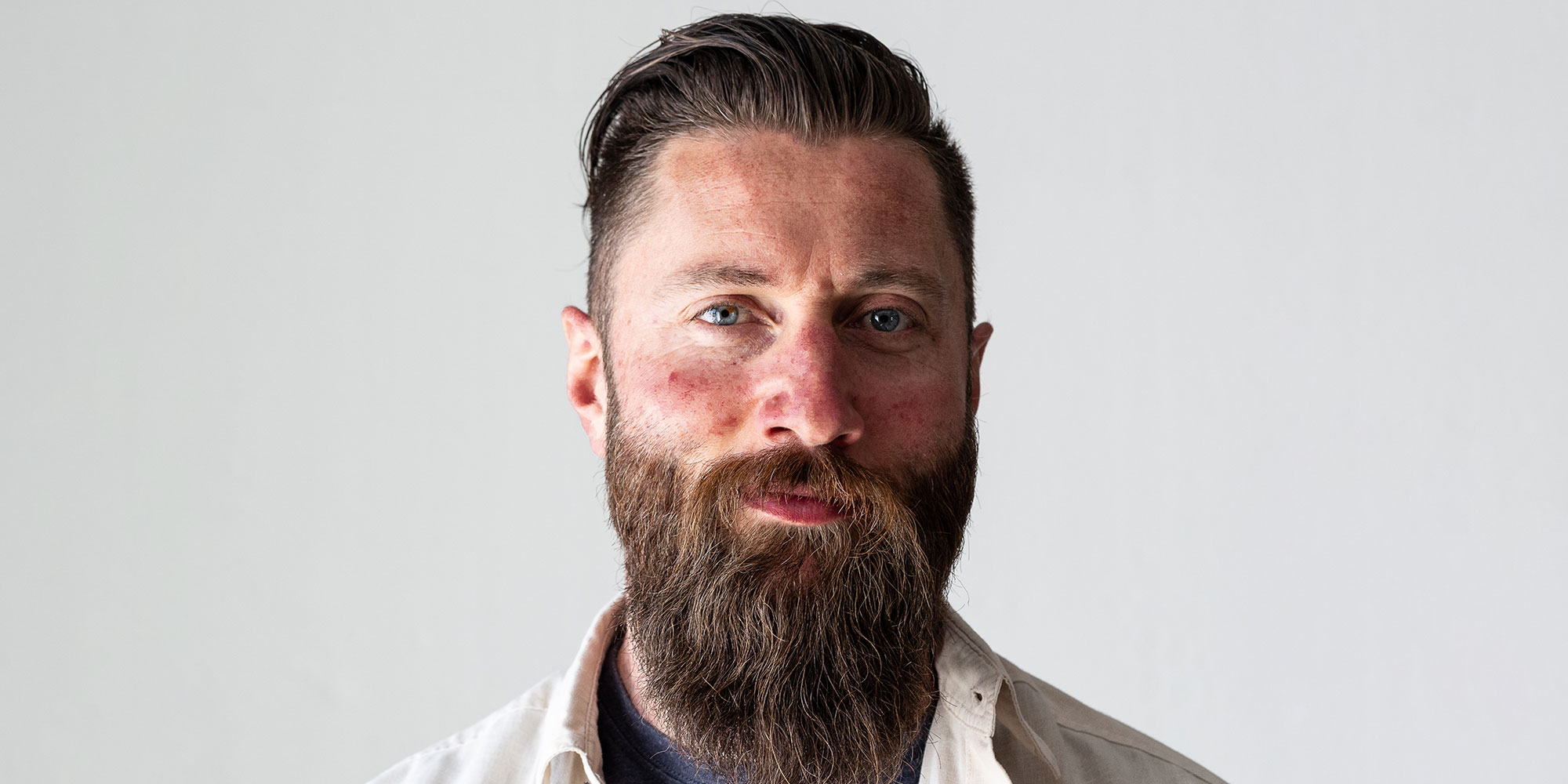 Man with rosacea