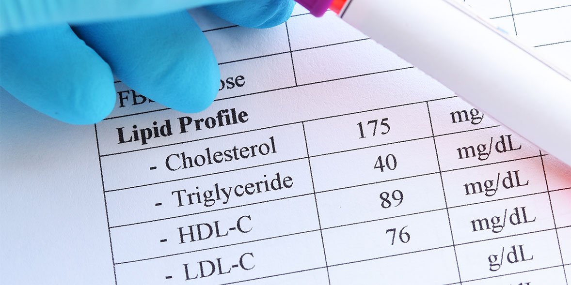 Reading a cholesterol results report