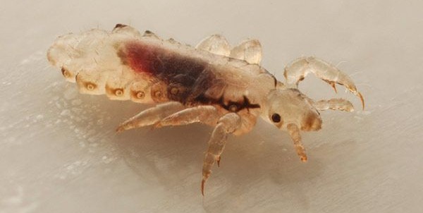 Head lice